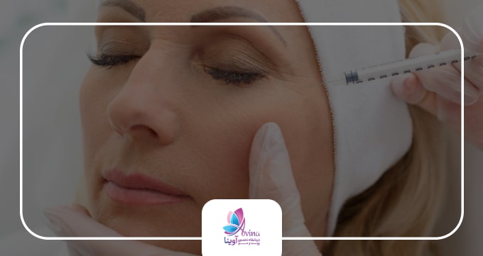 چگونگی انجام تزریق بوتاکس