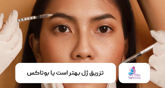 تزریق ژل بهتر است یا بوتاکس