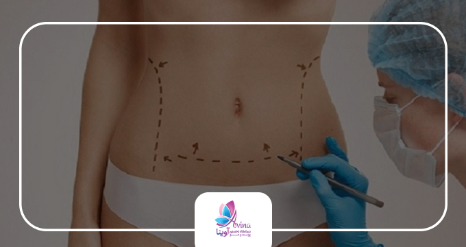 لیپوماتیک چیست و چگونه انجام میشود؟