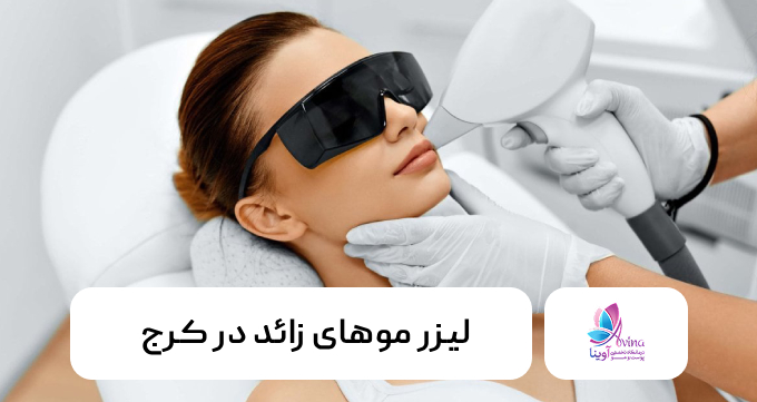 لیزر موهای زائد در کرج