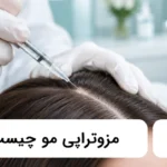 مزوتراپی مو چیست؟ ✅【سال1405】⭐