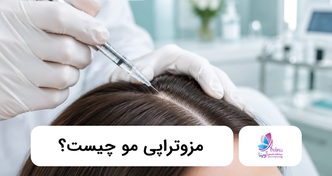 مزوتراپی مو چیست؟ ✅【سال1405】⭐