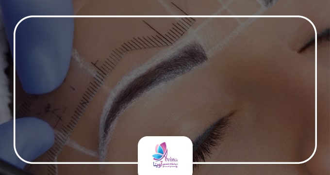 هزینه کاشت ابرو