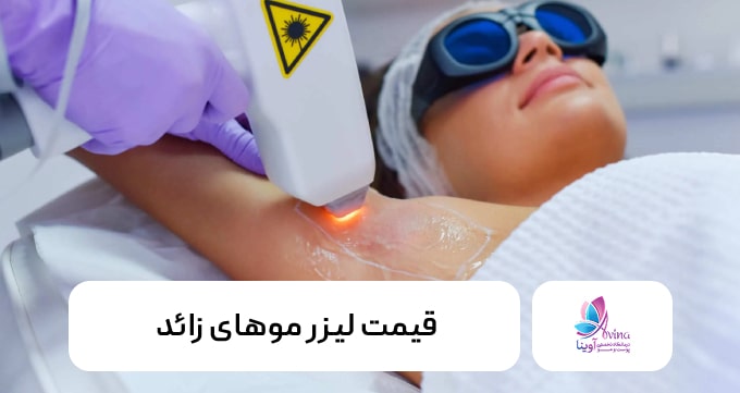 قیمت لیزر موهای زائد