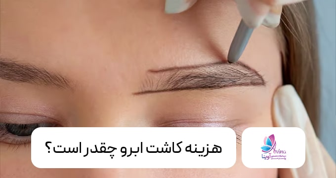 هزینه کاشت ابرو چقدر است؟