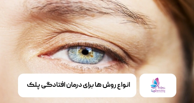 انواع روش ها برای درمان افتادگی پلک