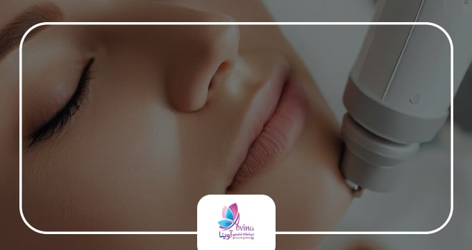 مراحل انجام آر اف فرکشنال