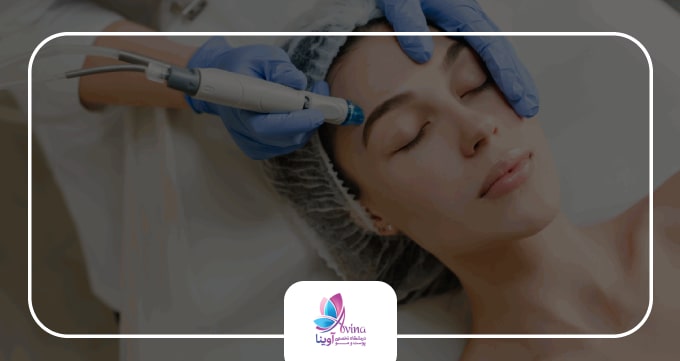 اقدامات قبل و بعد از آر اف فرکشنال