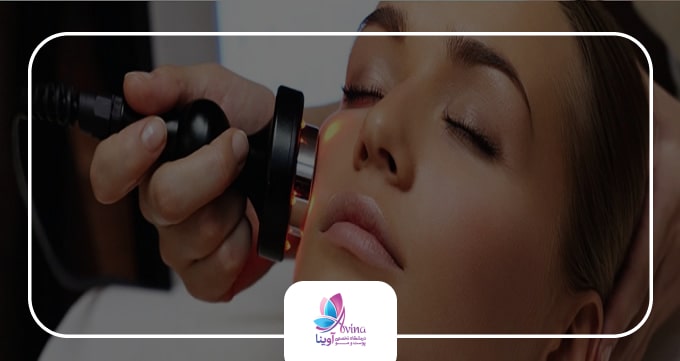 آر اف فرکشنال چگونه کار می کند؟