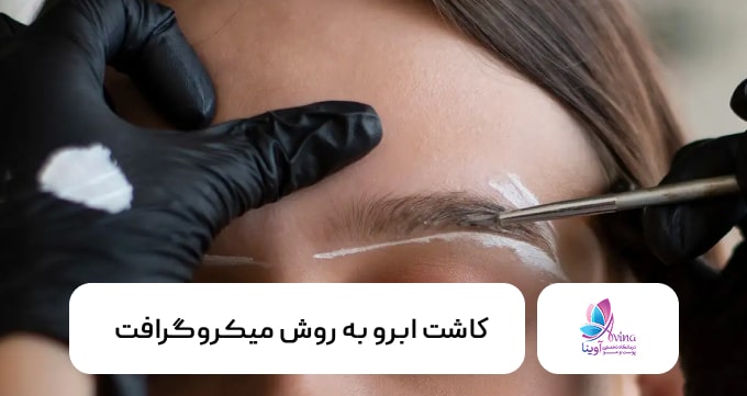 کاشت ابرو به روش میکروگرافت