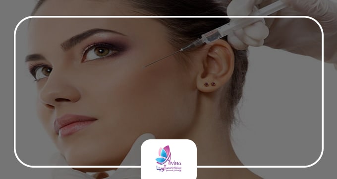 انواع تزریق ژل زیر چشم