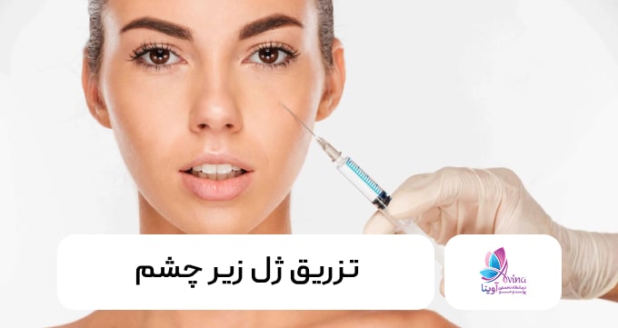تزریق ژل زیر چشم