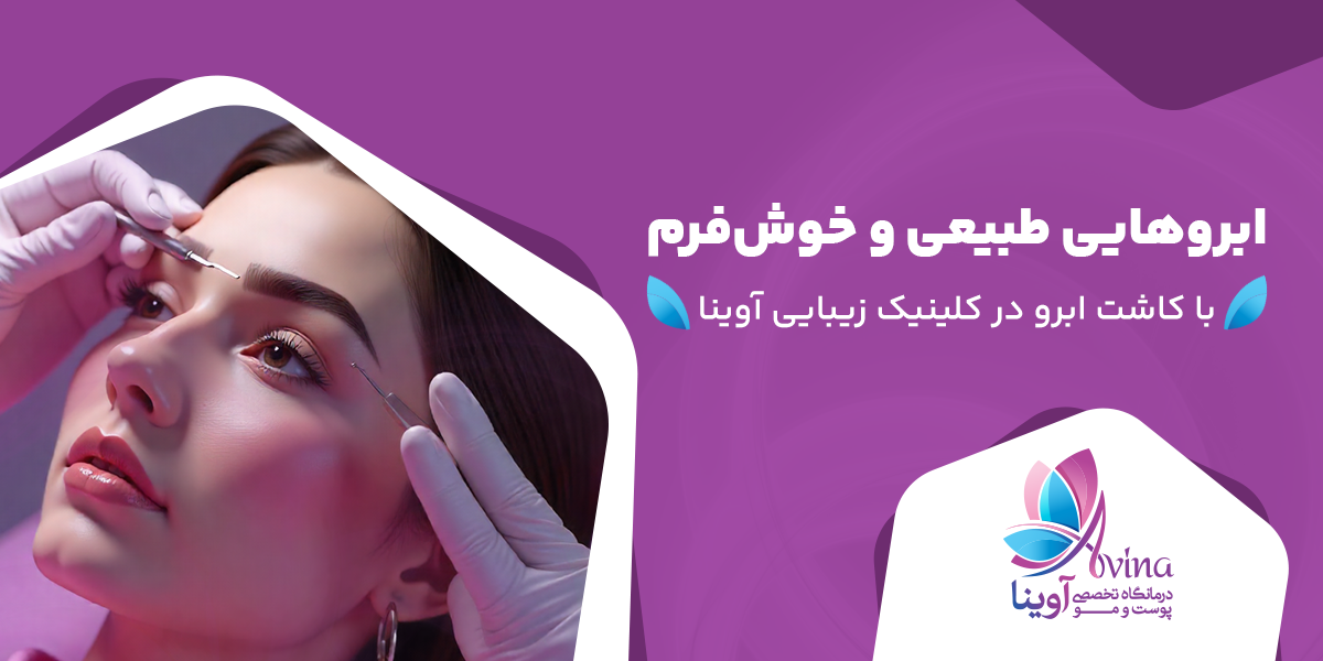 ابروهای طبیعی در کلینیک آوینا کرج
