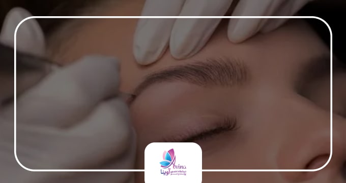 آیا نتیجه کاشت ابرو دائمی است؟