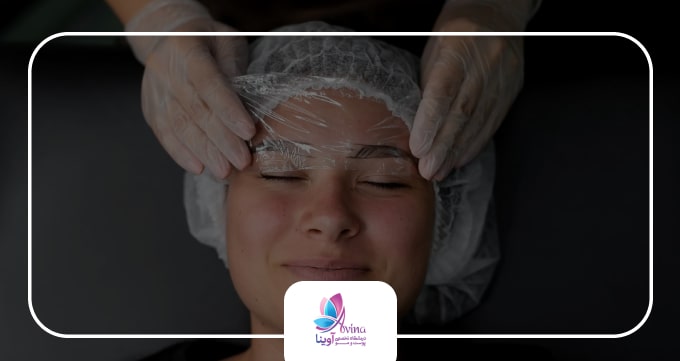 علتهای ریزش یا کمپشتی ابرو