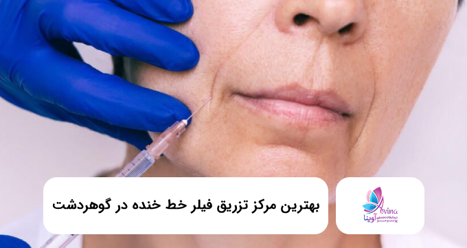 بهترین مرکز تزریق فیلر خط خنده در گوهردشت✅【سال1405】⭐
