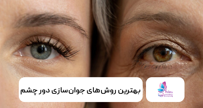 بهترین روشهای جوانسازی دور چشم