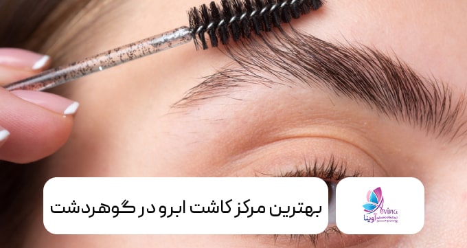بهترین مرکز کاشت ابرو در گوهردشت