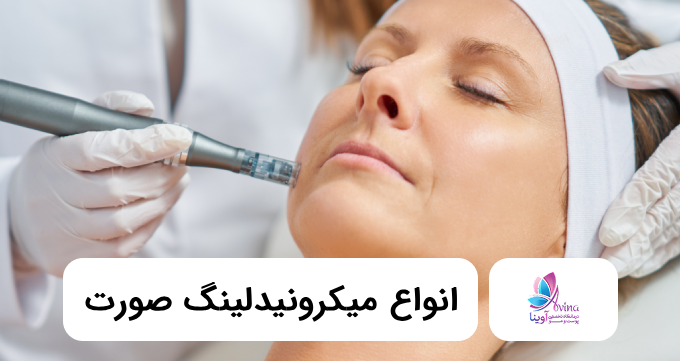 انواع میکرونیدلینگ صورت⚡【سال1405】✅