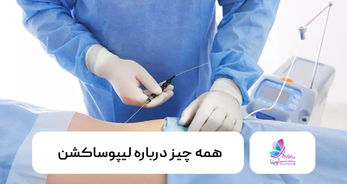 همه چیز درباره لیپوساکشن