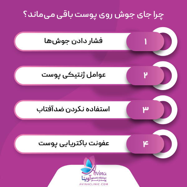 علتهای باقی ماندن جای جوش روی پوست