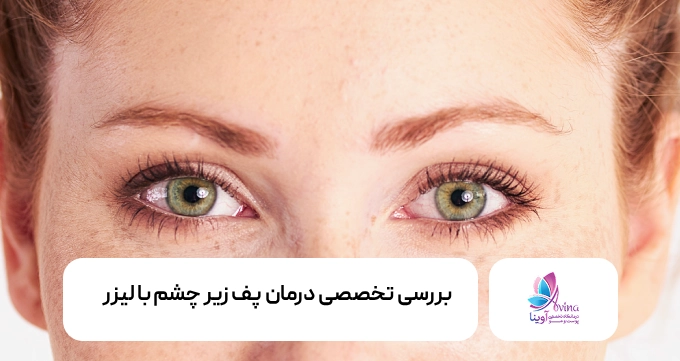 درمان پف زیر چشم با لیزر