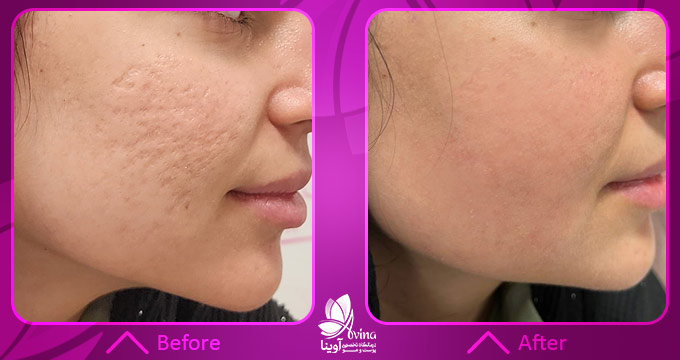 مشاورههای پزشکی در زمینه مراقبت از پوست