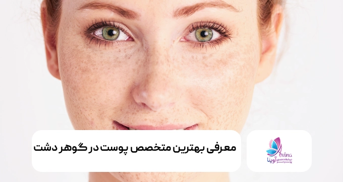 بهترین متخصص پوست در گوهردشت