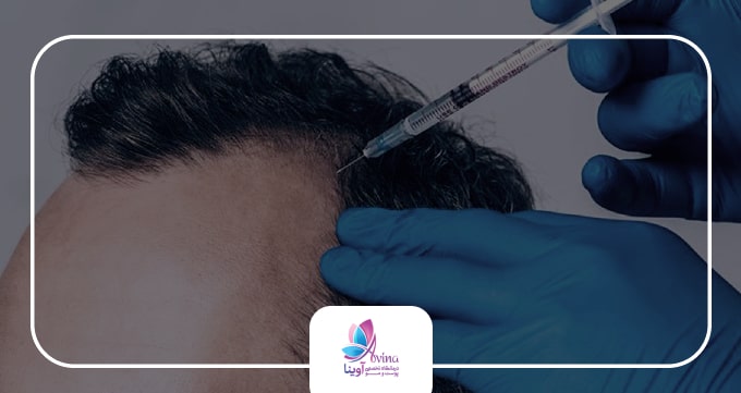 هیر فیلر چیست و چه کاربردی دارد؟