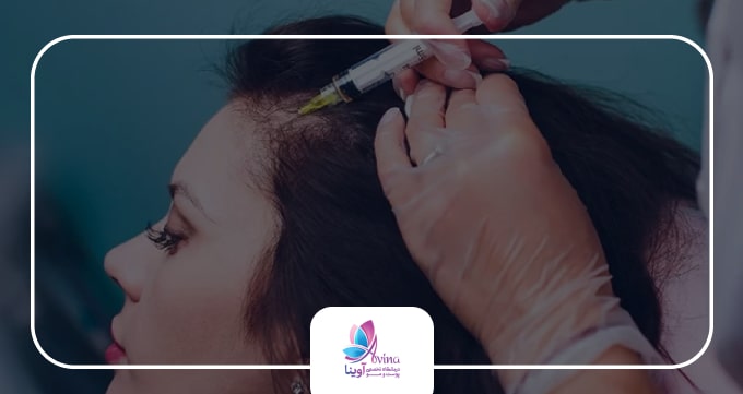 مراحل و نحوه تزریق هیر فیلر چگونه است؟