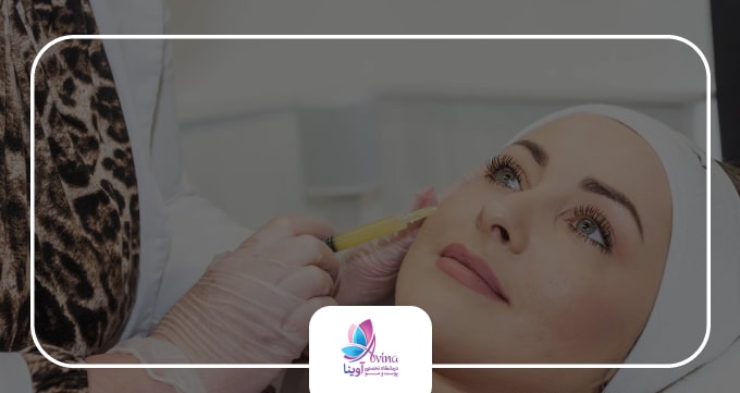 تعریف PRP چیست؟