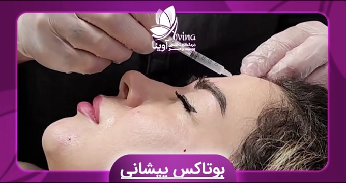 اهمیت انتخاب بهترین مرکز تزریق بوتاکس