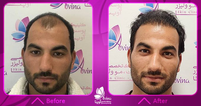 شناخت ساختار پوست و مو؛ پایهای برای درمانهای تخصصی