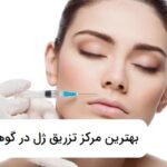 بهترین مرکز تزریق ژل در گوهردشت