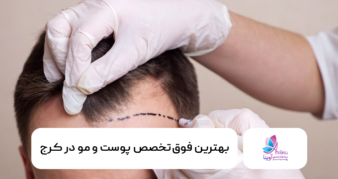 بهترین فوقتخصص پوست و مو در کرج