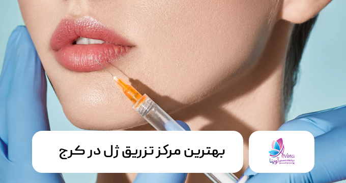 بهترین مرکز تزریق ژل در کرج