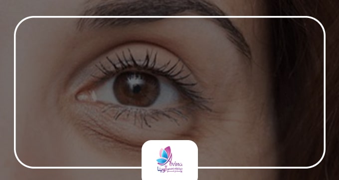 معرفی کلینیک آوینا و تخصص جراح