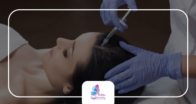 هیر فیلر چیست؟