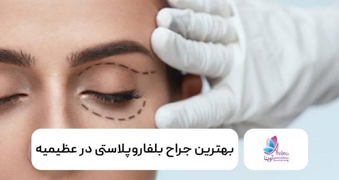 بهترین جراح بلفاروپلاستی در عظیمیه