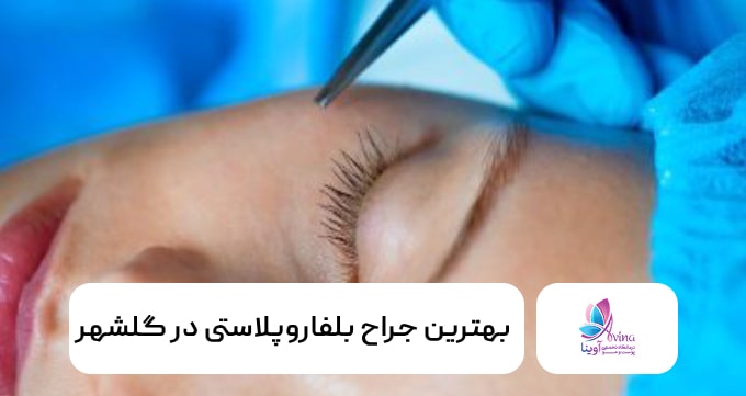 بهترین جراح بلفاروپلاستی در گلشهر
