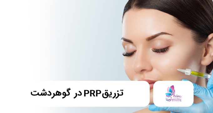 تزریق PRP در گوهردشت