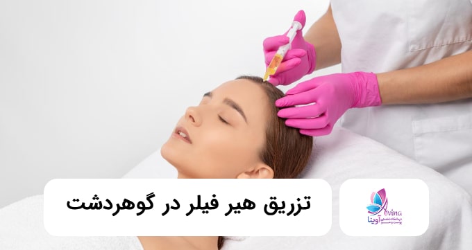 تزریق هیر فیلر در گوهردشت