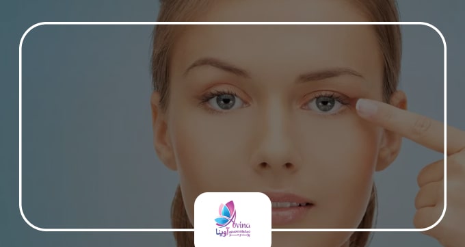 بوتاکس چیست و چرا محبوب است؟