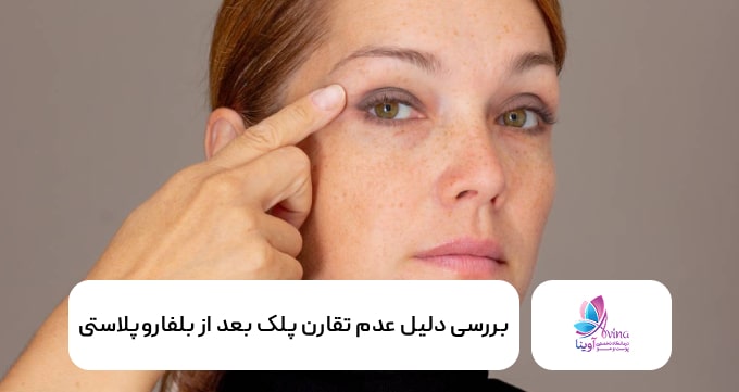 بررسی دلیل عدم تقارن پلک بعد از بلفاروپلاستی