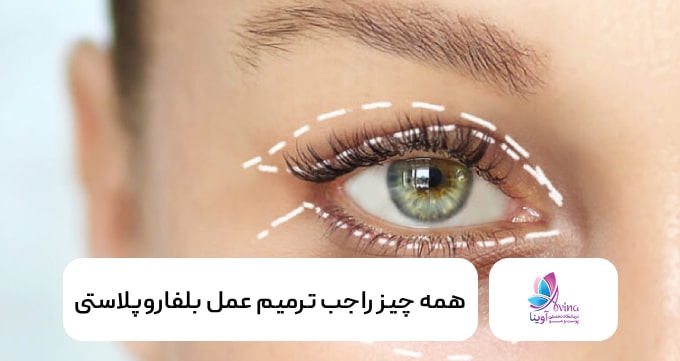 همه چیز راجب ترمیم عمل بلفاروپلاستی