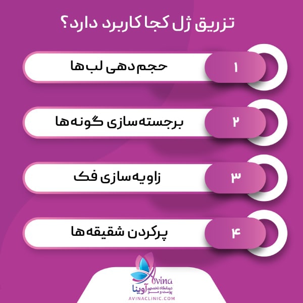 تزریق ژل برای چه نواحی صورت و بدن استفاده میشود؟