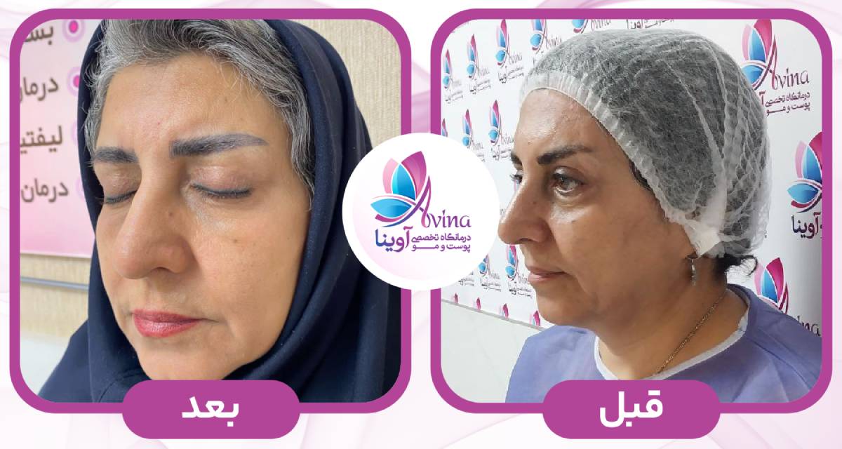 نگهداری نتایج و ماندگاری