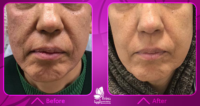 چرا پاکسازی پوست ضروری است؟