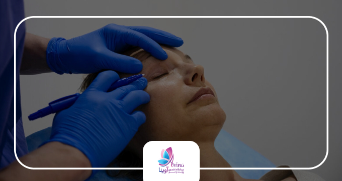 تفاوت رویکرد پزشک در بلفاروپلاستی درمانی و زیبایی