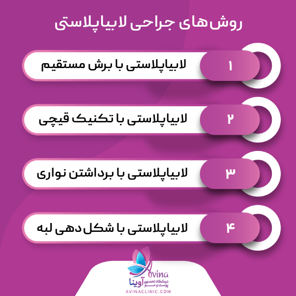 تکنیک جراحی لابیاپلاستی در کلینیک آوینا